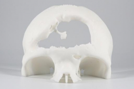 MyBone - © Cerhum MyBone - © Cerhum